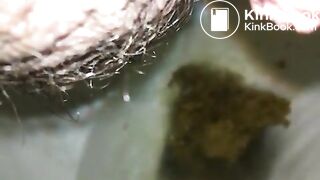 Me shitting