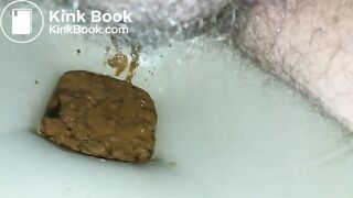 20170329_122325