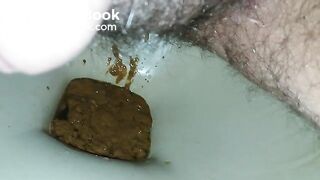 20170329_122325