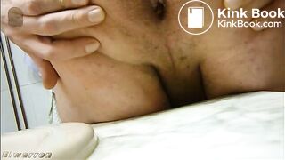 SCAT Una Mierda Maravillosa