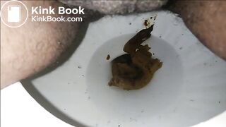 Toilet Shit 12232017