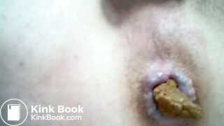 2017-08-01 08-29-50148