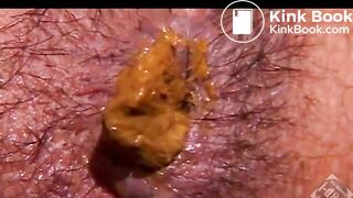 Eating Shit From Twinks Ass