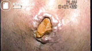 Close-up 1