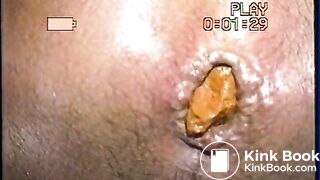 Close-up 1