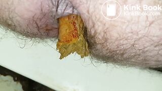 20180102_192809