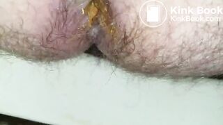 20180209_213642