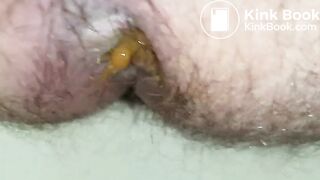 20180209_213642