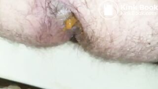 20180209_213642