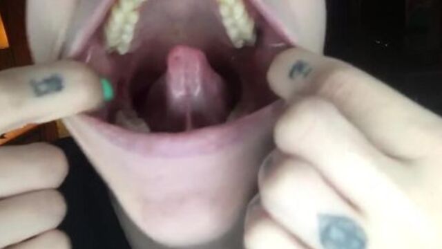 mouth fetish