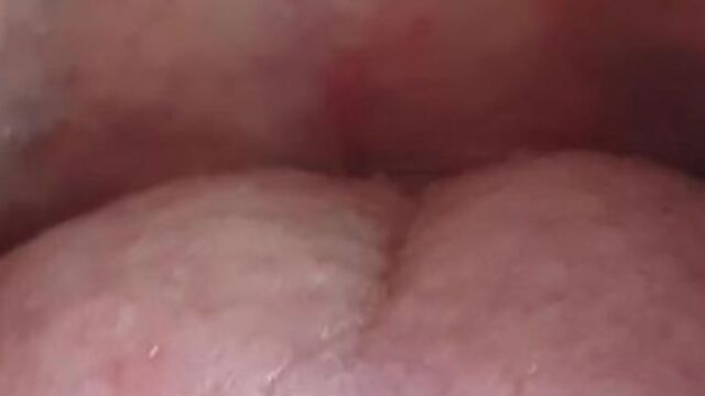 Gf Mouth Fetish Fillings