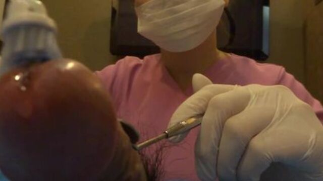 penis cleaning by a dental hygienist 2