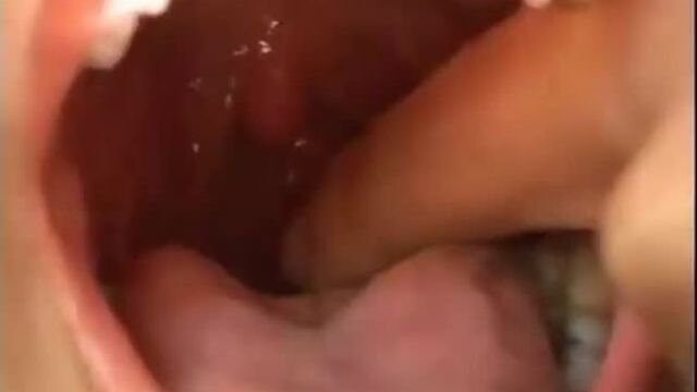 Close up of mouth and gagging
