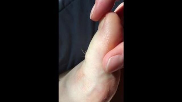 Hairy Girl Rubs Toes With Lotion