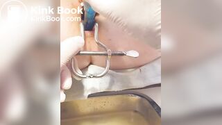 Urine sample at gynecology part 2/B