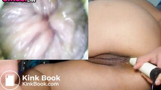 CAMGIRL DIRTY ANAL CAM DILDO COLONSCOPY SCAT