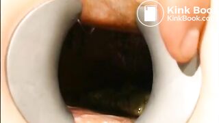 gynecologist find scat