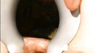 gynecologist find scat