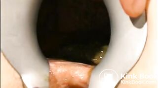 gynecologist find scat