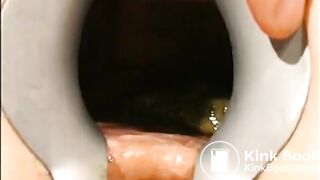gynecologist find scat