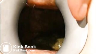 gynecologist find scat