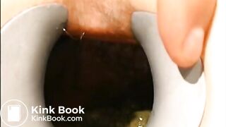 gynecologist find scat