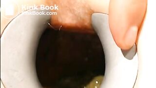 gynecologist find scat