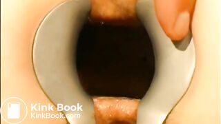 gynecologist find scat