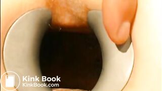 gynecologist find scat