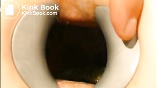 gynecologist find scat