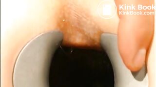 gynecologist find scat