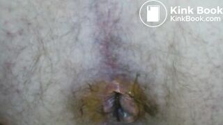 6: Pooping closeups, lots of shit