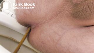 Urgent shit - came out fast!