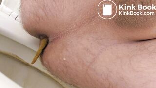 Urgent shit - came out fast!