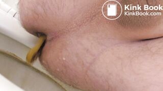 Urgent shit - came out fast!