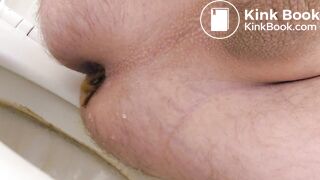 Urgent shit - came out fast!