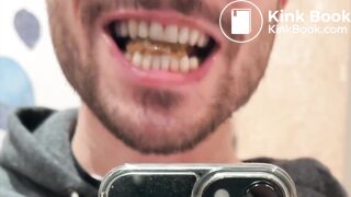 guy shits and eats it, with photos