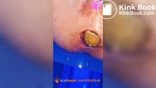 Dixie POV massive shits