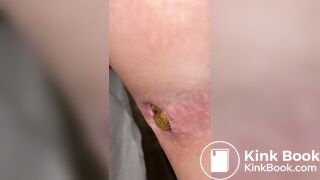 SCAT - Hot girls Pooping