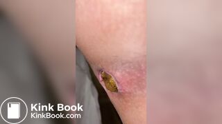 SCAT - Hot girls Pooping