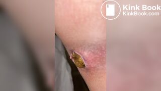 SCAT - Hot girls Pooping