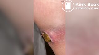 SCAT - Hot girls Pooping