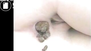 SCAT - Hot girls Pooping