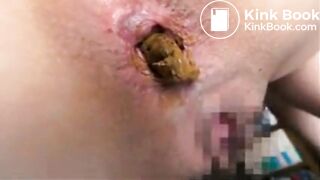 SCAT - Hot girls Pooping