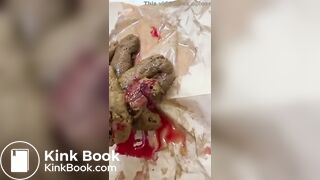 SCAT - Sexy girls Pooping 11