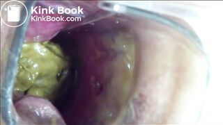 SCAT - Sexy girls Pooping 34