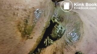 Watch My Shitting Ass and Dirty Pussy