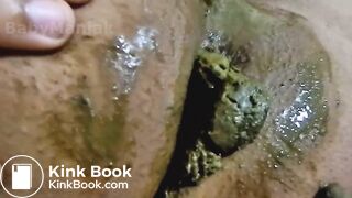 Watch My Shitting Ass and Dirty Pussy