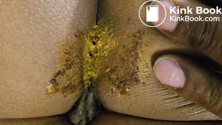 Sleeping GF dirty asshole for cleaning