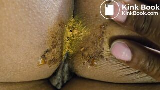 Sleeping GF dirty asshole for cleaning